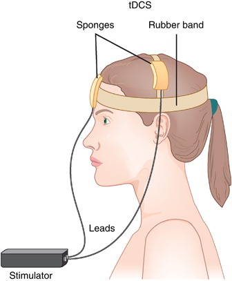tDCS1